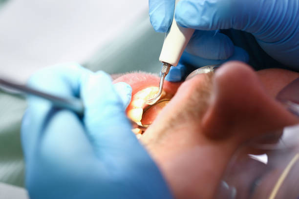 Best Emergency Broken Tooth Repair in Barker Heights, NC