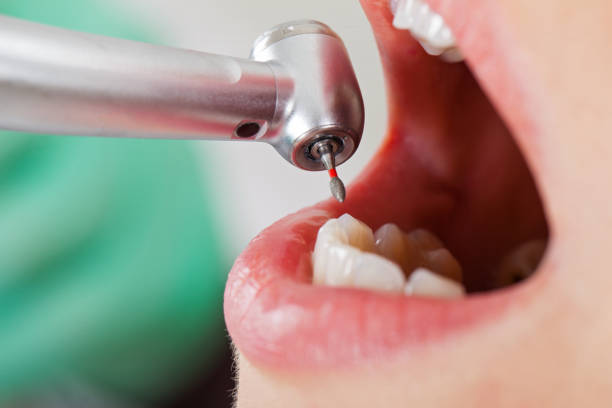 Best Emergency Treatment for Toothache in Barker Heights, NC